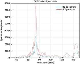 動(dòng)態(tài)離散周期變換技術(shù)突破：無(wú)ECG參考的生理信號(hào)精準(zhǔn)解析